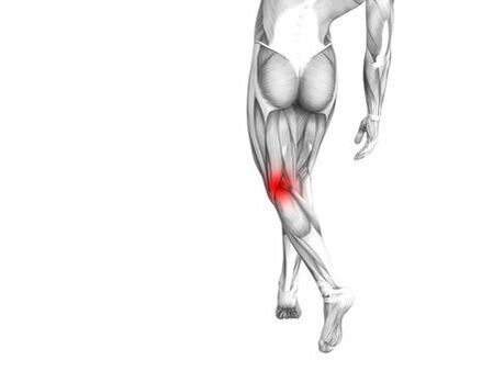 Arthrose van het kniegewricht