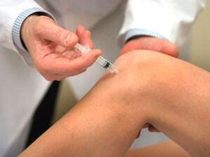 Hoe artrose van het kniegewricht te behandelen