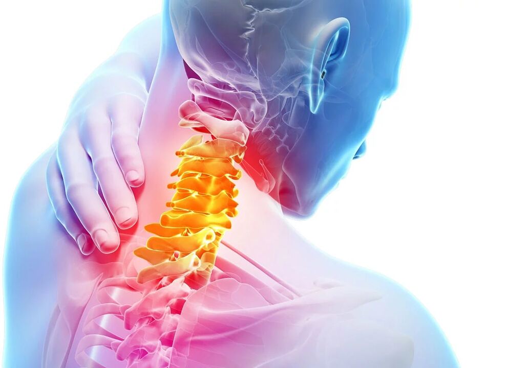 Cervicale osteochondrose