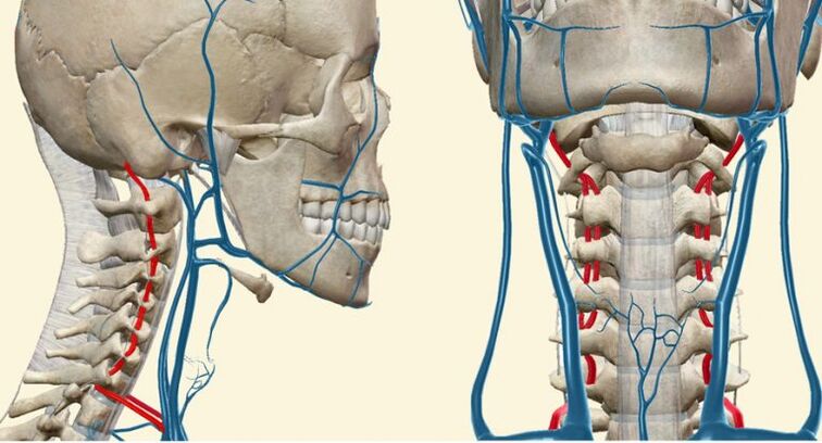Vasculair syndroom bij osteochondrose